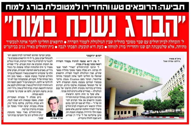 הבורג נשכח במוח