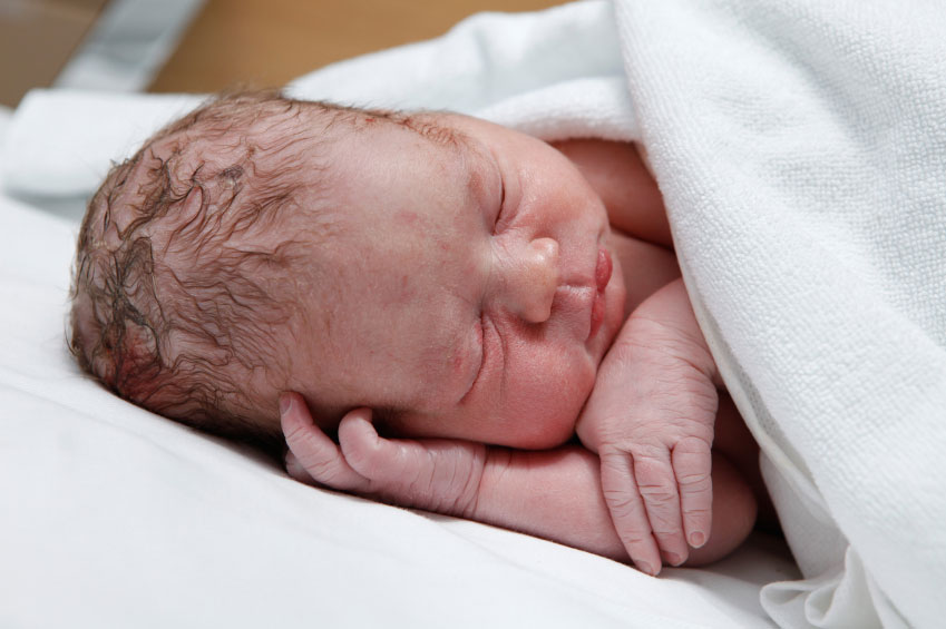 מום קשה בלידה