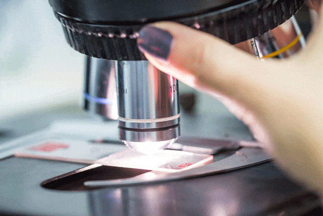 ‏‏בדיקת ביופסיה